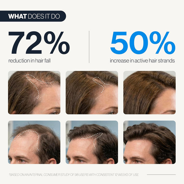 Hair Growth Wonder Serum